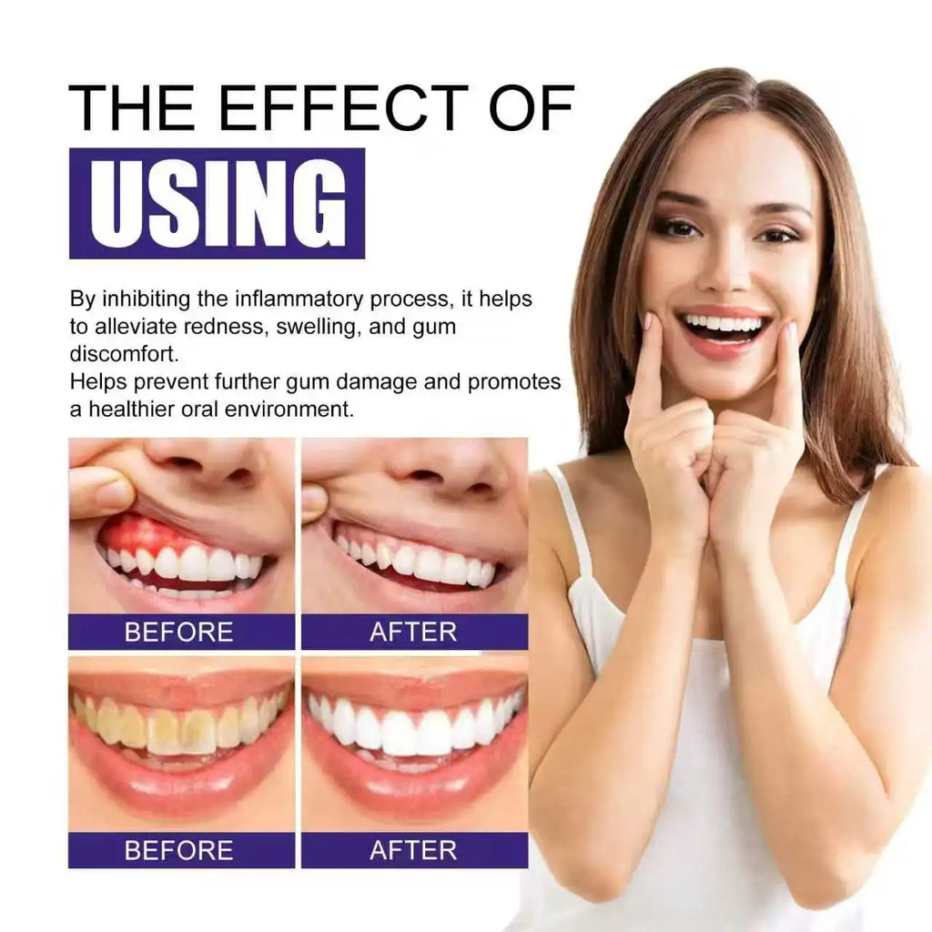 Breath & Flex™ Advanced Oral Red Light Therapy Device – Natural Gum Care & Tooth Pain Relief