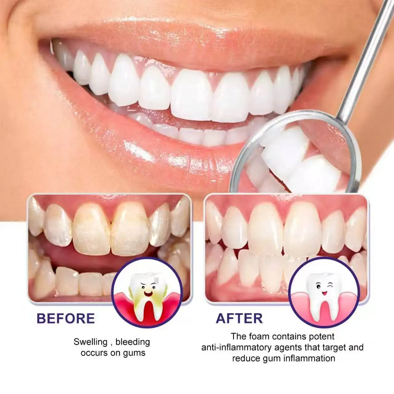 Breath & Flex™ Advanced Oral Red Light Therapy Device – Natural Gum Care & Tooth Pain Relief